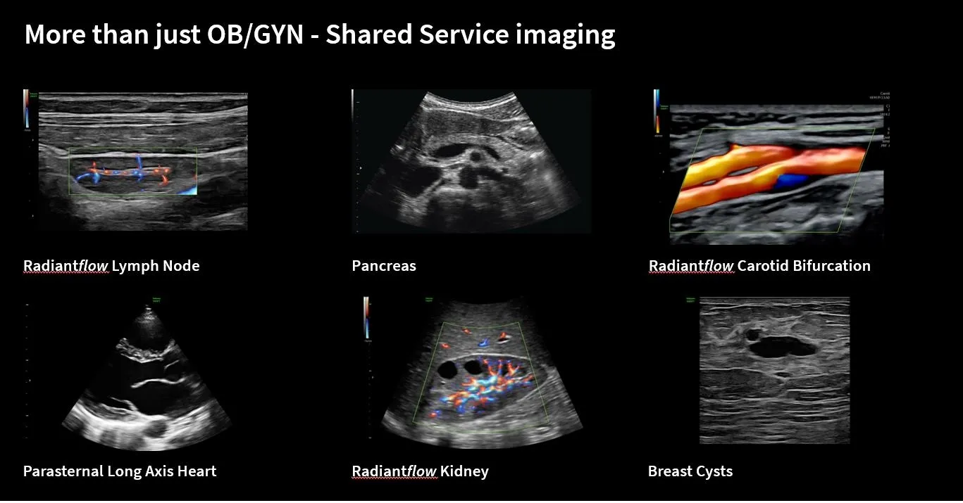 Shadow Reduction imaging comparison