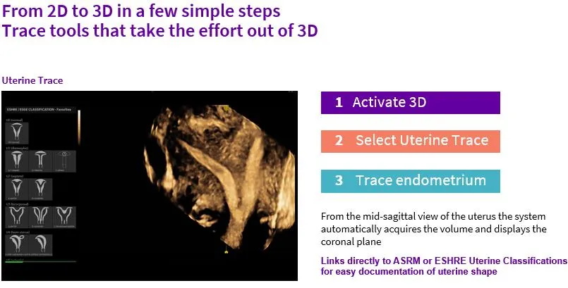 Flow Profiles Doppler at RITU IVF