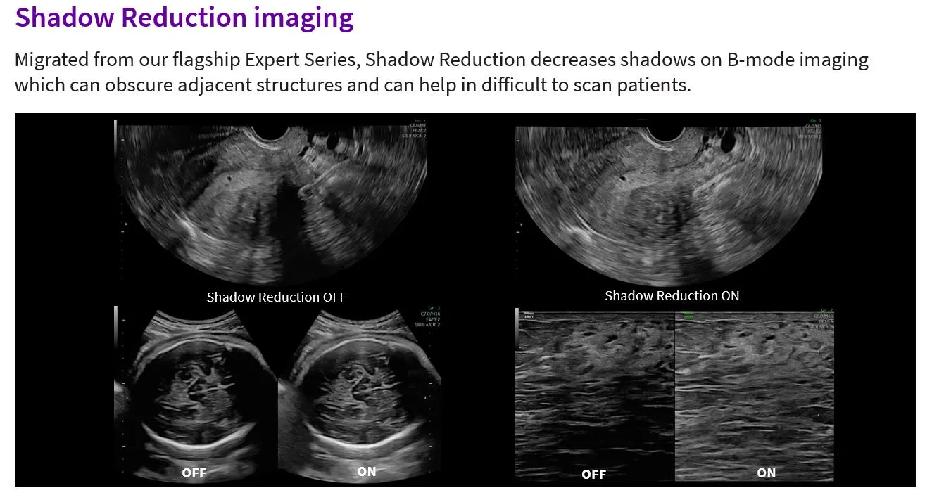 Shadow Reduction comparison