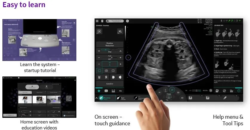 Uterine Trace 3D imaging at RITU IVF